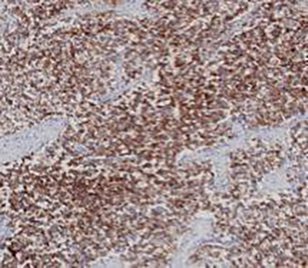 PLAP Recombinant Mouse Monoclonal Antibody (clone BPM6151)