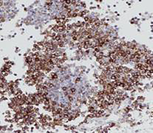TdT Recombinant Rabbit Monoclonal Antibody (clone BP6089)