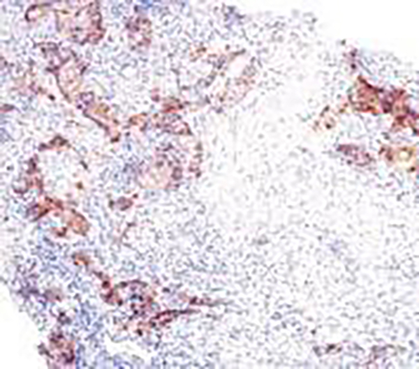 ROS1 Recombinant Rabbit Monoclonal Antibody (clone BP6215)