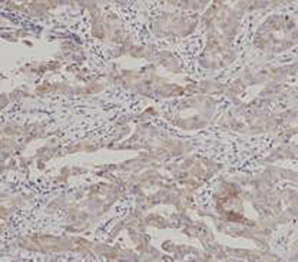 EGFR Recombinant Rabbit Monoclonal Antibody (clone BP6097)