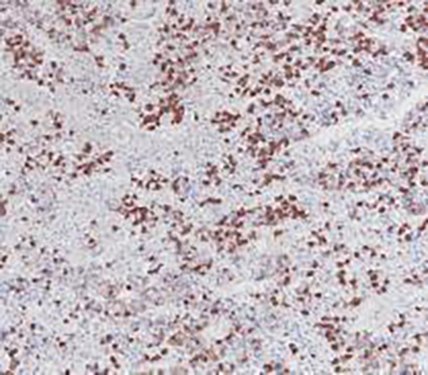 Growth Hormone Recombinant Mouse Monoclonal Antibody (clone BPM6190)