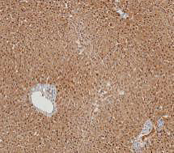 Arginase-1 Recombinant Rabbit Monoclonal Antibody (clone BP6158)
