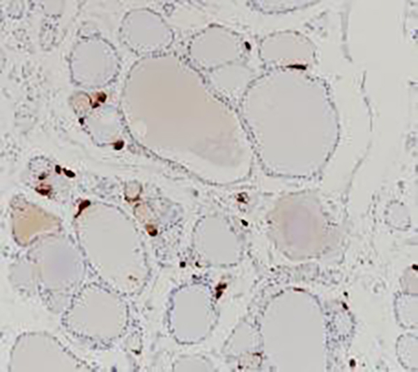 Procalcitonin Recombinant Rabbit Monoclonal Antibody (clone BP6237)