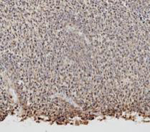 Myelin Basic Protein Recombinant Rabbit Monoclonal Antibody (clone BP6087)