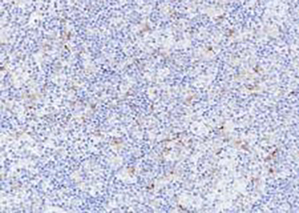 Tim-3 Recombinant Rabbit Monoclonal Antibody (clone BP6182)