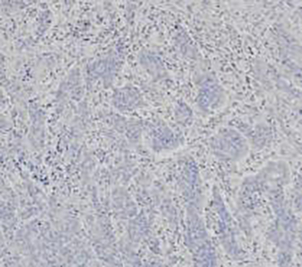Insulin Recombinant Mouse Monoclonal Antibody (clone 2D11-H5)