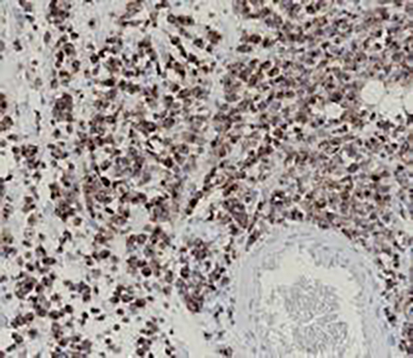 ZAP-70 Recombinant Rabbit Monoclonal Antibody (clone BP6106)