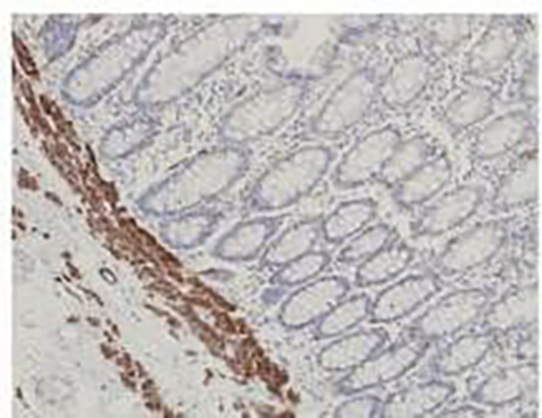 Caldesmon Recombinant Mouse Monoclonal Antibody (clone h-CALD)