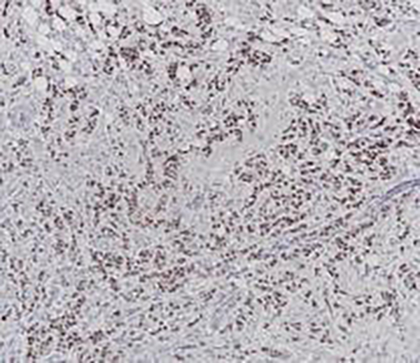 CD20 Recombinant Rabbit Monoclonal Antibody (clone BP6138)