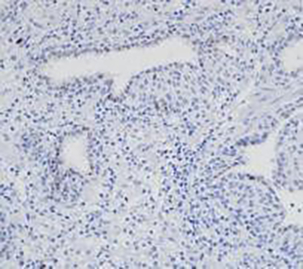 AR V7 Recombinant Rabbit Monoclonal Antibody (clone BP6152)