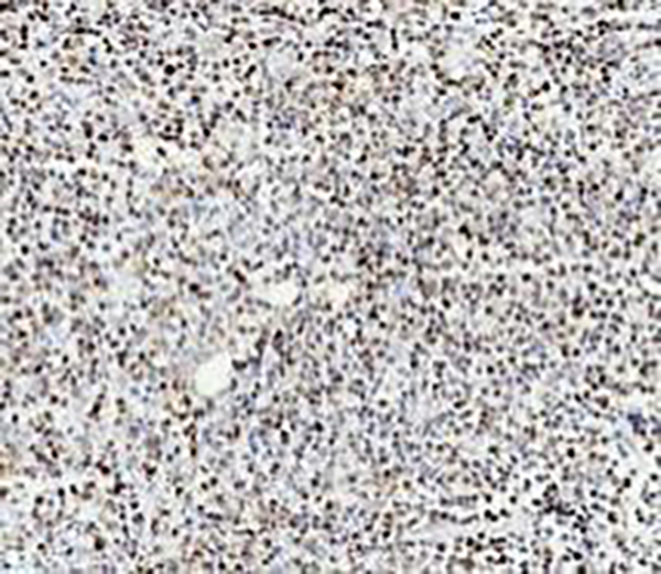 p120 Recombinant Rabbit Monoclonal Antibody (clone BP6075)