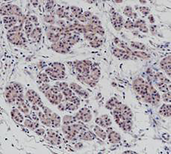 SMAD 4 Recombinant Rabbit Monoclonal Antibody (clone BP6219)