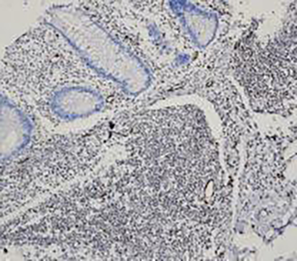 Androgen Receptor Recombinant Rabbit Monoclonal Antibody (clone BP6126)