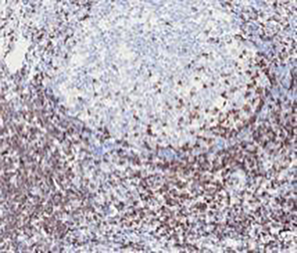 CD7 Recombinant Rabbit Monoclonal Antibody (clone BP6105)