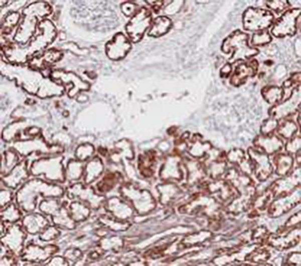SDHB Recombinant Rabbit Monoclonal Antibody (clone BP6160)