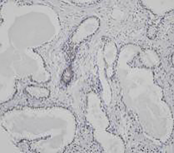 Mammaglobin Recombinant Rabbit Monoclonal Antibody (clone BP6125)