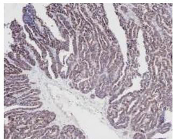 PAX-8 Recombinant Rabbit Monoclonal Antibody (clone BP6157)