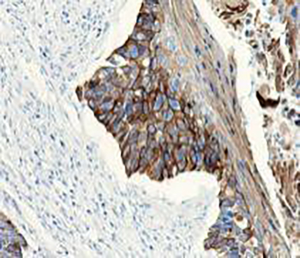 AMACR Recombinant Rabbit Monoclonal Antibody (clone BP6115)