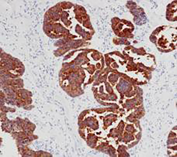Claudin 6 Recombinant Rabbit Monoclonal Antibody (clone BP6274)