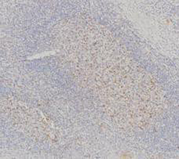 TIGIT Recombinant Rabbit Monoclonal Antibody (clone BP6272)