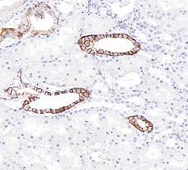 L1CAM Recombinant Rabbit Monoclonal Antibody (clone BP6257)