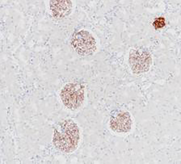 COL4A3 Recombinant Rabbit Monoclonal Antibody (clone BP6254)