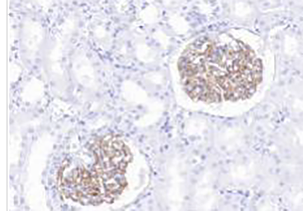 PLA2R Recombinant Rabbit Monoclonal Antibody (clone BP6284)