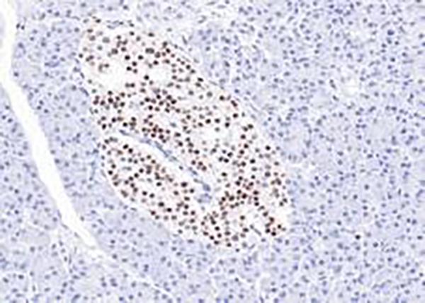 Islet-1 Recombinant Rabbit Monoclonal Antibody (clone BP6280)