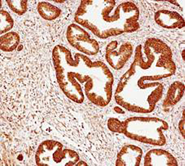 Calreticulin Recombinant Rabbit Monoclonal Antibody (clone BP6279)