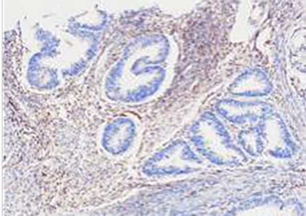 PTEN Recombinant Rabbit Monoclonal Antibody (clone BP6283)