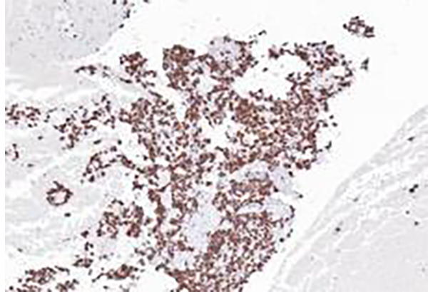 H3K27M Recombinant Rabbit Monoclonal Antibody (clone BP6294)