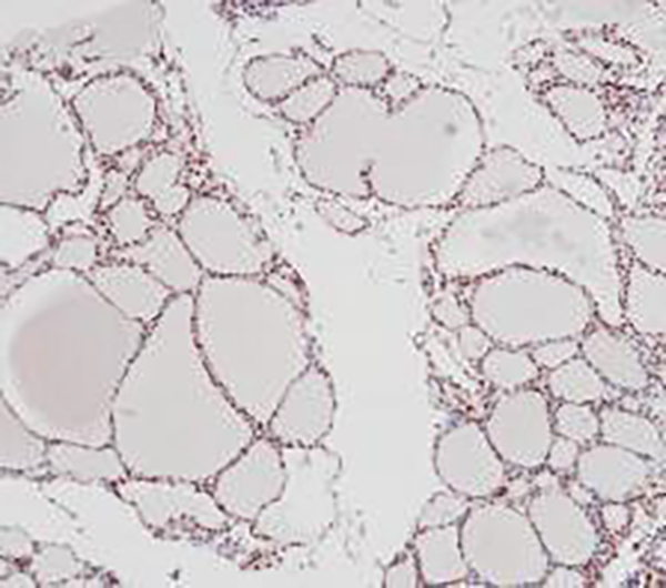 Parafibromin Recombinant Rabbit Monoclonal Antibody (clone BP6290)