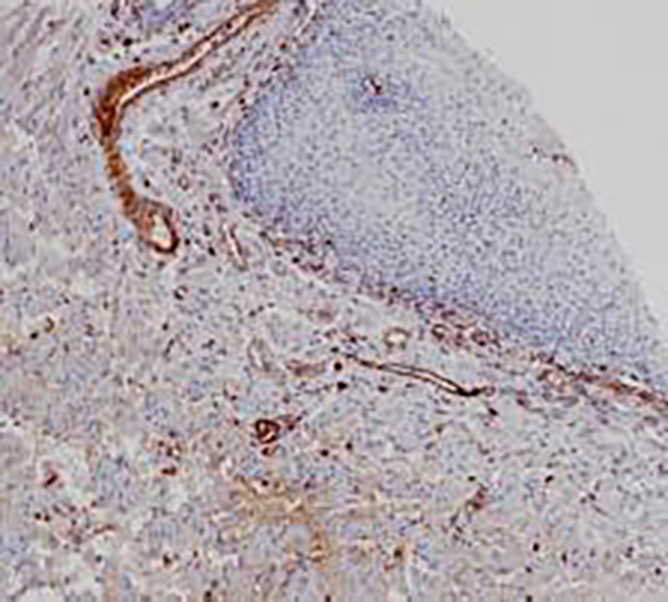 Hemoglobin &alpha; Recombinant Rabbit Monoclonal Antibody (clone BP6267)