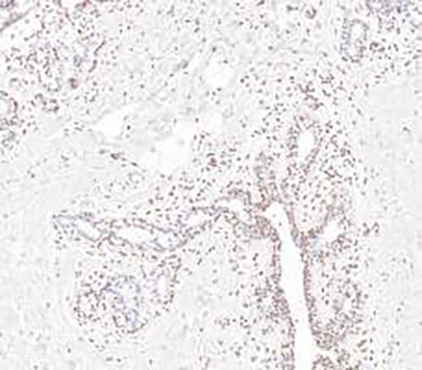 pan-Cadherin Recombinant Rabbit Monoclonal Antibody (clone BP6296)