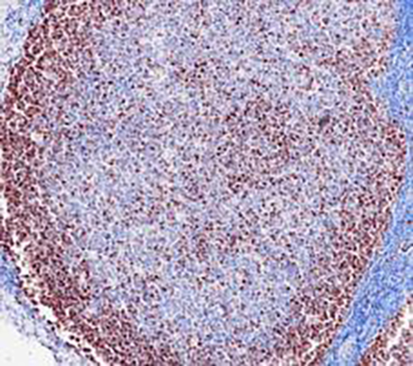 Survivin Recombinant Rabbit Monoclonal Antibody (clone BP6259)