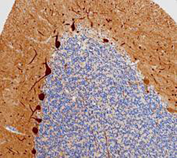 Parvalbumin &alpha; Recombinant Rabbit Monoclonal Antibody (clone BP6278)
