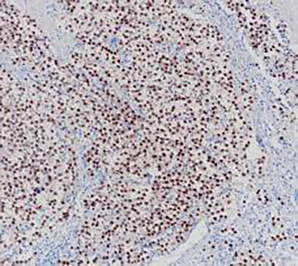 OCT3/4 Recombinant Rabbit Monoclonal Antibody (clone BP6282)