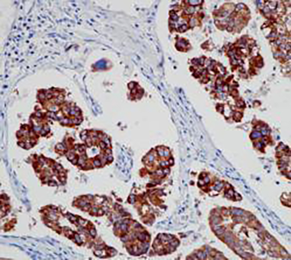 IMP-3 Recombinant Rabbit Monoclonal Antibody (clone BP6264)