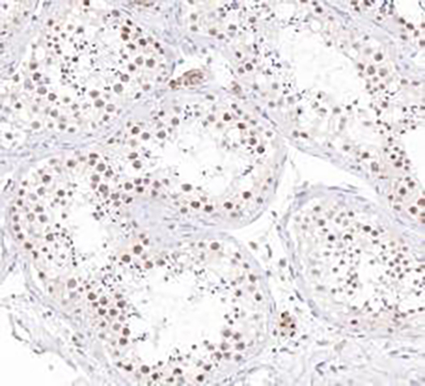 EZH2 Recombinant Rabbit Monoclonal Antibody (clone BP6269)