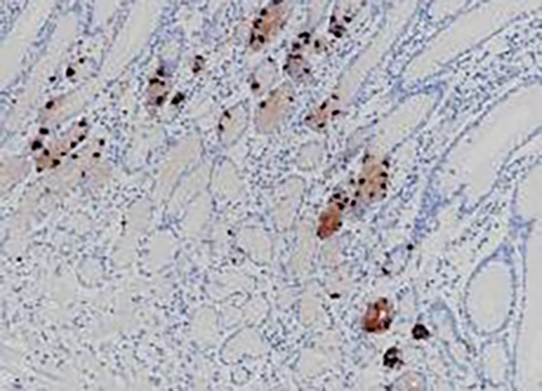 Gastrin Recombinant Rabbit Monoclonal Antibody (clone BP6253)