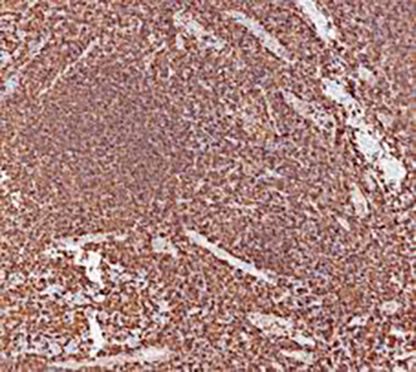 MHC II Recombinant Rabbit Monoclonal Antibody (clone BP6270)