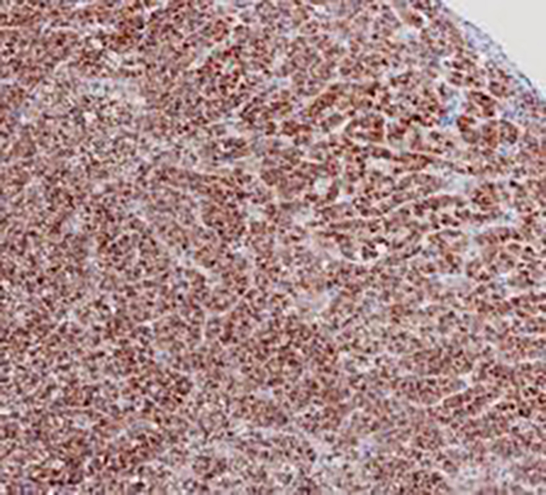 STAR Recombinant Rabbit Monoclonal Antibody (clone BP6262)