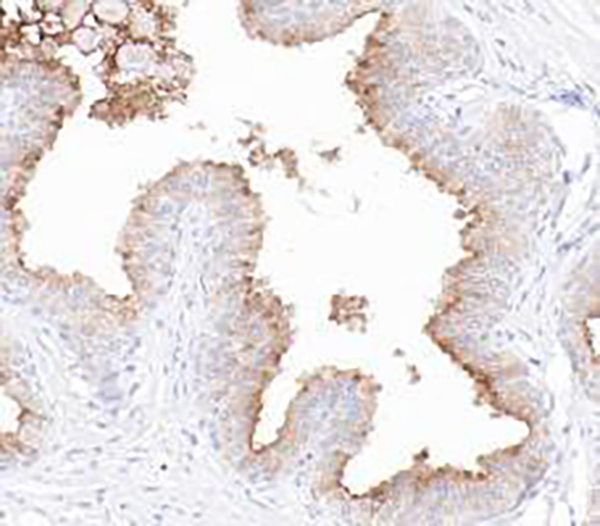 PSMA Recombinant Rabbit Monoclonal Antibody (clone BP6276)