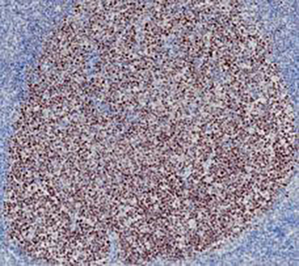 Bcl-6 Recombinant Rabbit Monoclonal Antibody (clone BP6261)