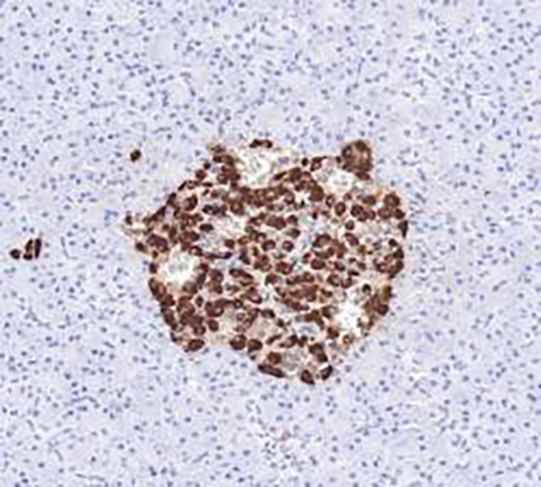 Nestin Recombinant Rabbit Monoclonal Antibody (clone BP6275)