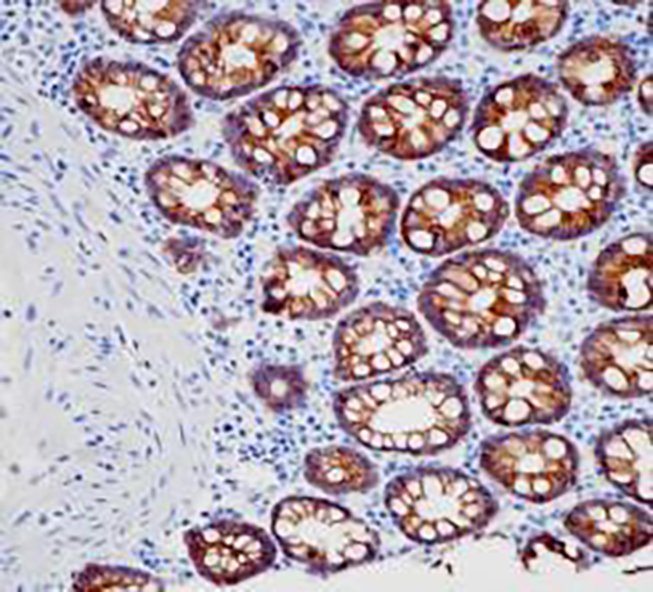 CDH17 Recombinant Rabbit Monoclonal Antibody (clone BP6266)
