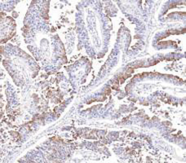Uroplakin 1a (UPK1A) Recombinant Rabbit Monoclonal Antibody (clone BP6293)