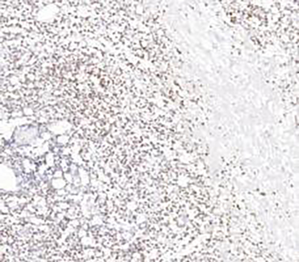 TIA-1 Recombinant Rabbit Monoclonal Antibody (clone BP6295)