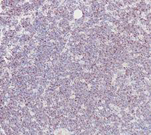 c-Myc Recombinant Rabbit Monoclonal Antibody (clone BP6258)