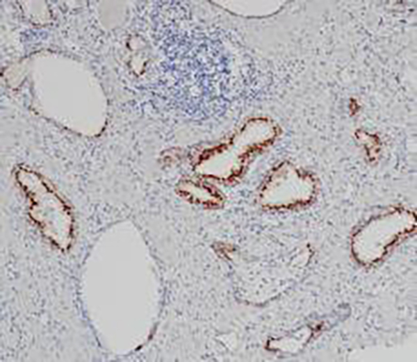SATB2 Recombinant Rabbit Monoclonal Antibody (clone BP6298)